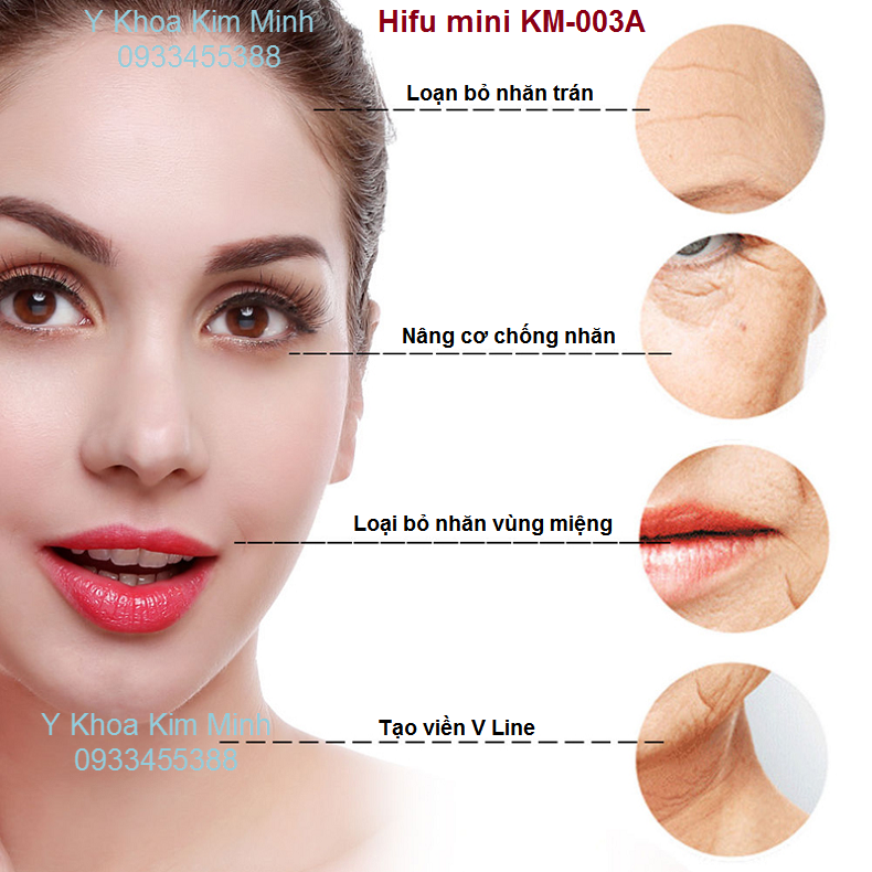 May cang da xoa nhan hifu mini KM-003A chuyen dung cho ca nhan va homspa ban tai TP hochiminh 0933455388