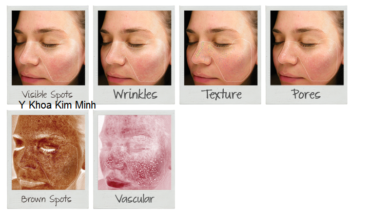 HDSD may kiem tra da mini DM-19 Y Khoa Kim Minh