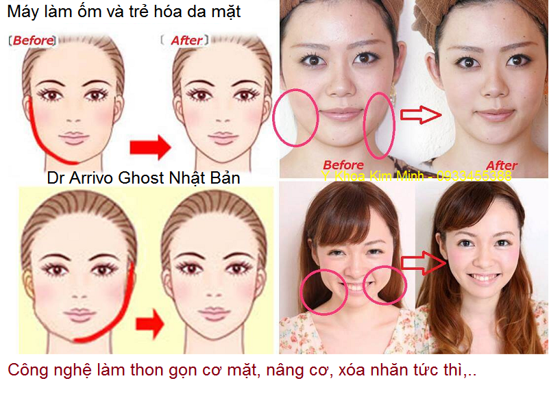 May lam om co mat, may chong nhan, tre hoa da tuc thi Dr Arrivo Ghost Nhat Ban - Y khoa Kim Minh 0933455388