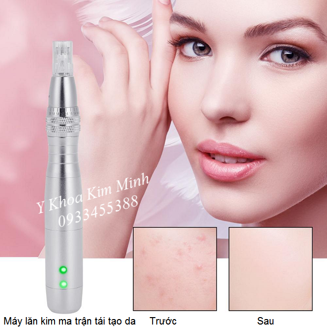 Máy chuyên phi kim cấy tảo trẻ hóa da mặt - Y Khoa Kim Minh Máy phi kim cấy tảo trẻ hóa da - Y khoa Kim Minh 0933455388
