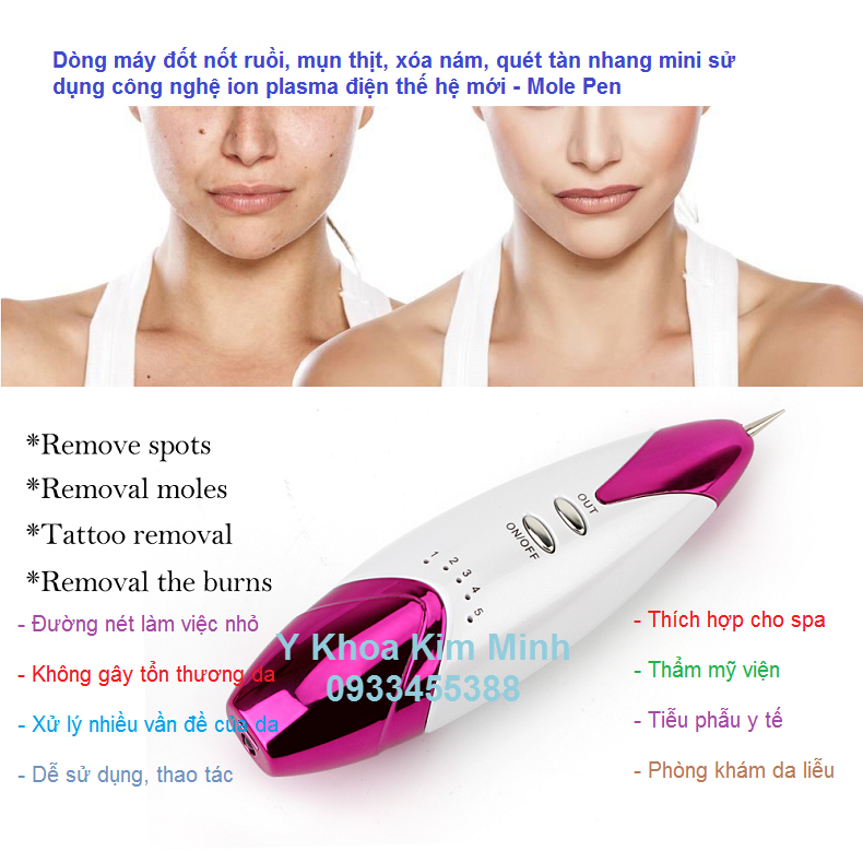 May dot not ruoi quet nam xoa tan nhang mini cam tay Mole Pen Y Khoa Kim Minh 0933455388