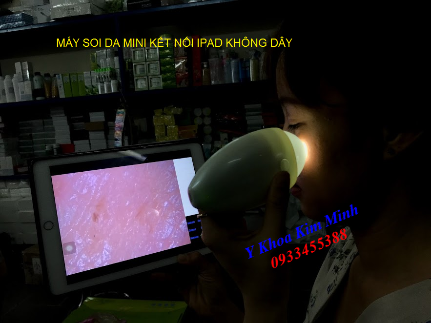 Máy soi da kết nối ipad không dây - Y Khoa Kim Minh May soi da ket noi ipad khong day qua wifi phan tich kiem tra da - Y Khoa Kim Minh 0933455388