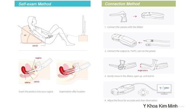 May soi kiem tra am dao benh phu khoa Kim Minh