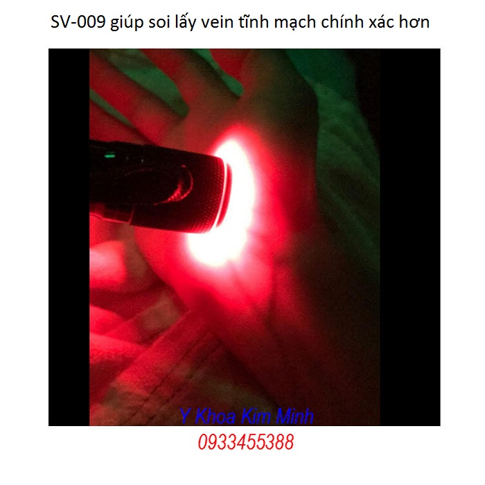 May soi lay vein tinh mach tay, chan, ho tro phau thuat tham my - Y khoa Kim Minh