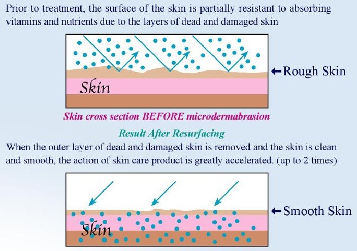 Máy trị nám trị mụn tái tạo da sinh học KM-034