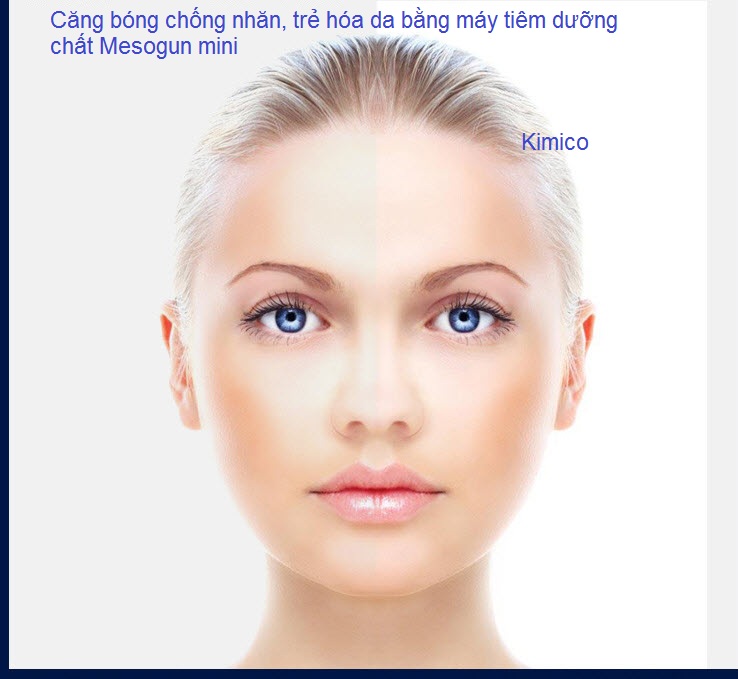 Tiem duong chat cang bong chong nhan bang may mesogun mini ban tai Y Khoa Kim Minh 0933455388