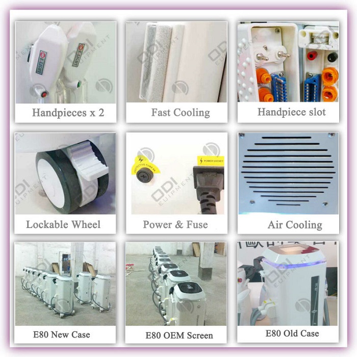 Địa chỉ b&aacute;n m&aacute;y triệt l&ocirc;ng Elight KE-80 Y Khoa Kim Minh S&agrave;i g&ograve;n