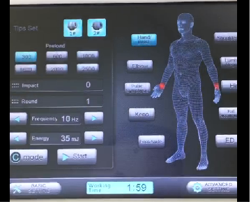 Máy xung kích chữa hội chứng đau ống cổ tay - Y Khoa Kim Minh May xung kich chua hoi chung dau ong co tay ESWT-Pro - Y Khoa Kim Minh