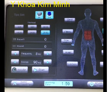Máy xung kích Shock Wave chữa đau lưng - Y khoa Kim Minh Máy xung kích Shock Wave chữa đau lưng - Y khoa Kim Minh
