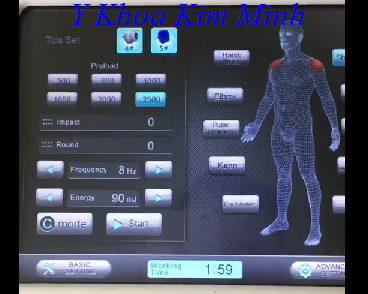 May xung kich chua dau vai gay - Y Khoa Kim Minh May xung kich chua dau vai gay - Y Khoa Kim Minh