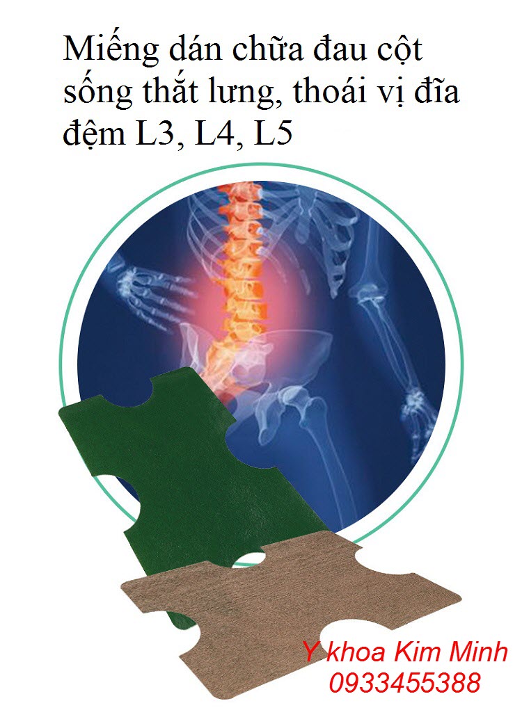 Miếng dán chữa đau thắt lưng, đau cột sống L3, L4, L5, thoát vị đĩa đệm cột sống lưng