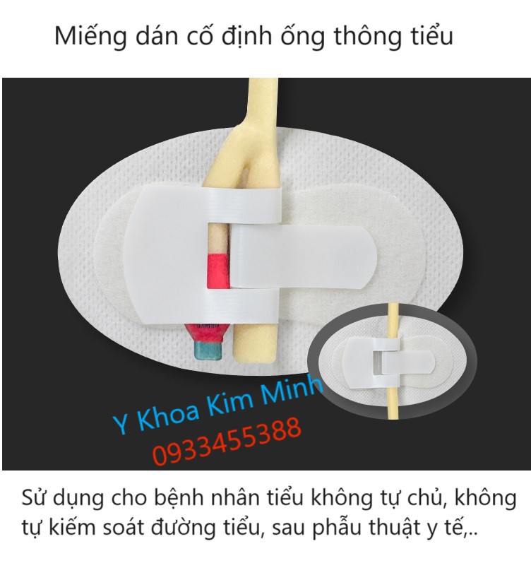Miếng dán cố định đường ống thông tiểu bệnh nhân tiểu không tự kiểm soát