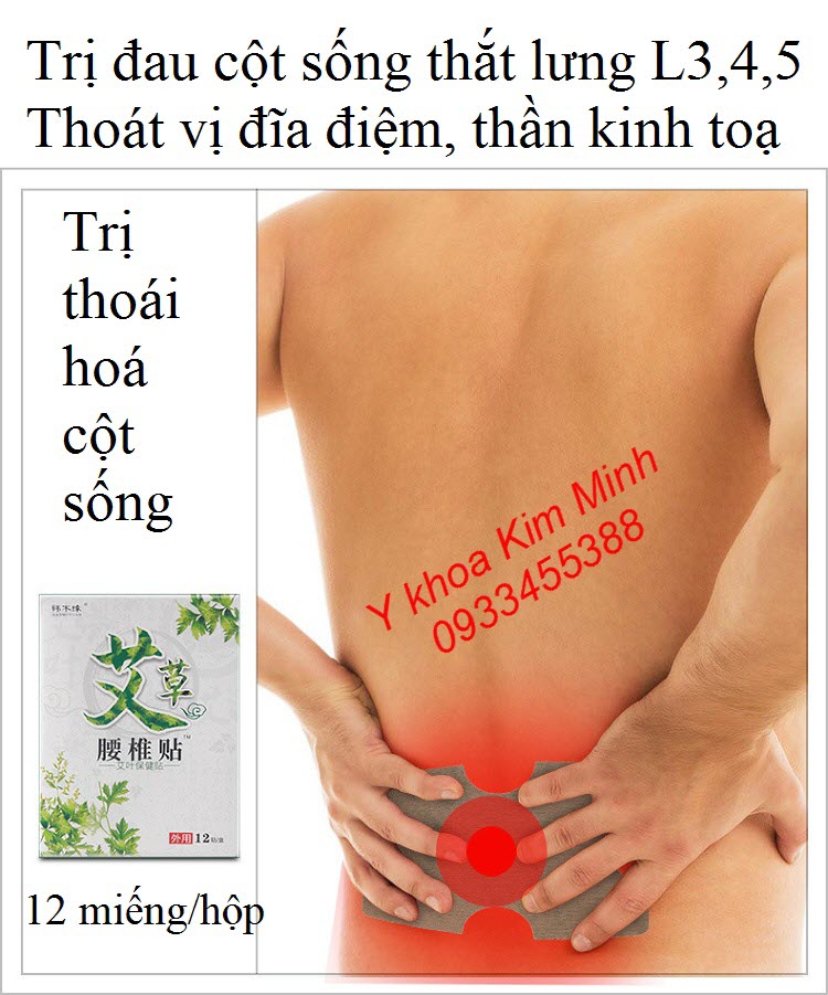 Miếng dán trị đau cột sống lưng, thần kinh toạ, thoái vị đĩa đệm L3, L4, L5 - Y khoa Kim Minh