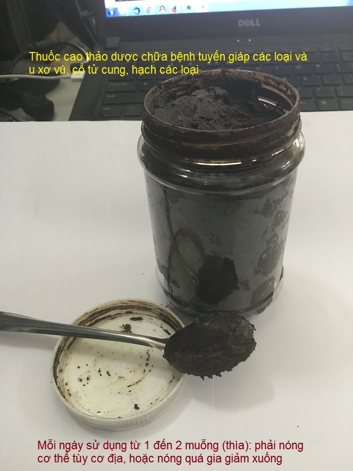 Chua benh buou co, suy giap, cuong giap, basedow, ba se do, u xo co tu cung, u nguc, u nang buong trung, Y Khoa Kim Minh
