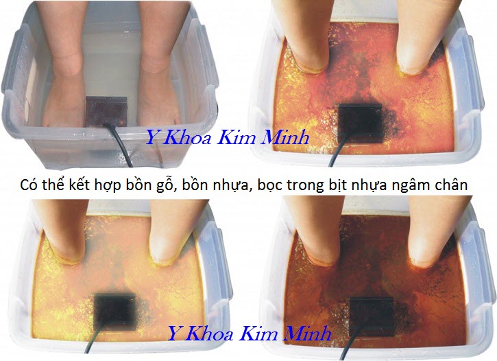 Dùng máy ion thải độc ngâm chân hàng ngày chứng minh là tốt cho sức khoẻ - Y Khoa Kim Minh