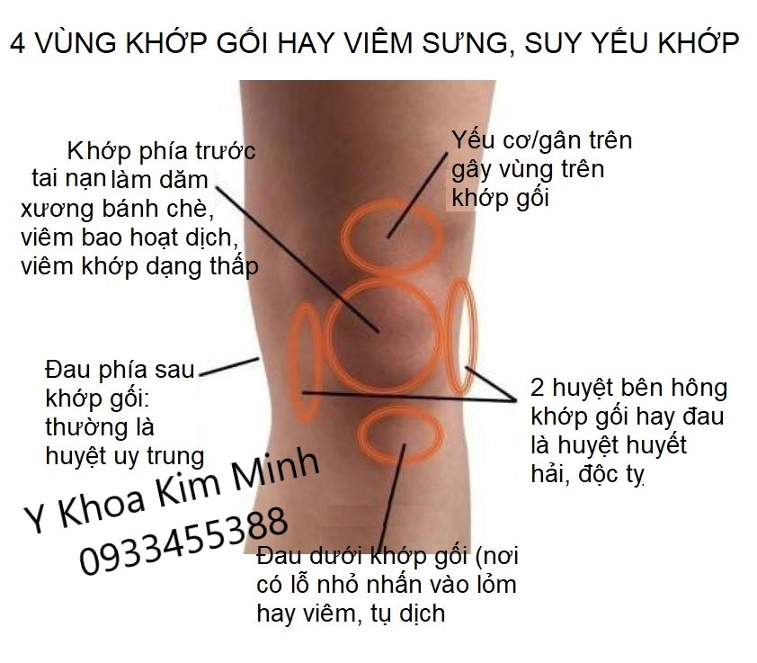 Nguyên nhân đau khớp gối