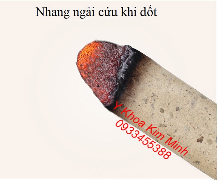 Nhang ngai cuu chua benh dau co xuong khop, viem khop goi rat hieu qua - Y khoa Kim Minh