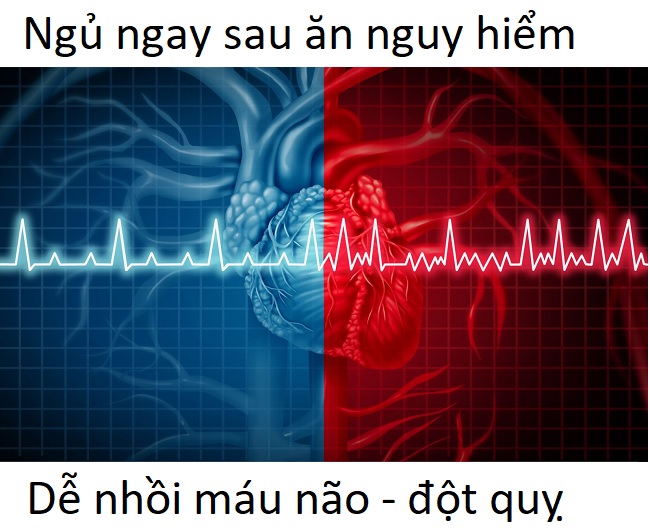 Tránh ngủ ngay vào buổi trưa sau khi ăn no - Y Khoa Kim Minh Ngủ ngay sau khi ăn trưa dễ gây nhồi máu não và đột quỵ - Y Khoa Kim Minh