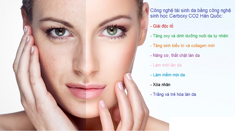 Tre hoa da mat bang cong nghe Carboxy CO2 Hàn Quốc - Y khoa Kim Minh