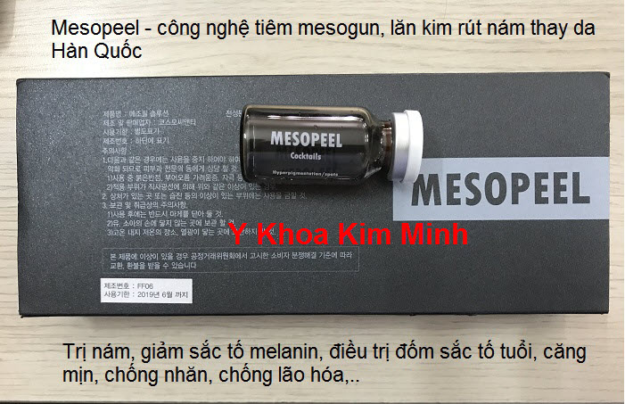 Noi ban mesopeel tri nam bang cach tiem mesogun lan kim - Y khoa Kim Minh