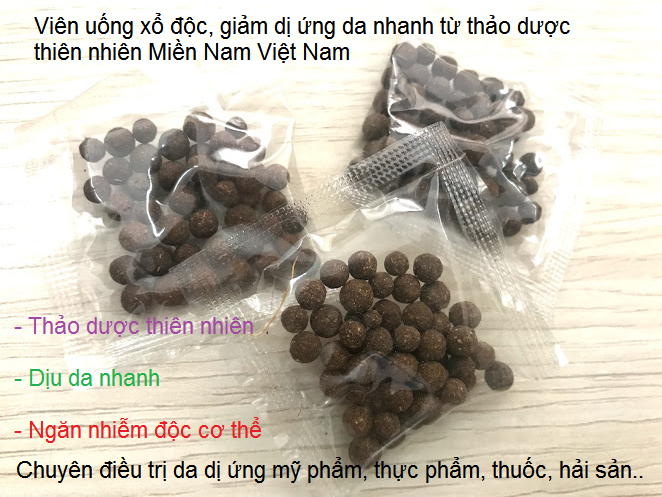 Viên thuốc điều trị dị ứng da bằng thảo dược Đông Y gia truyền gồm 5 loại thuốc quý - Y khoa Kim Minh Viên thuốc điều trị dị ứng da bởi mỹ phẩm, kem chăm sóc da, hải sản, thực phẩm, thuốc uống, côn trùng cắn bằng thảo dược Đông y Miền Nam Việt Nam - Y khoa Kim Minh