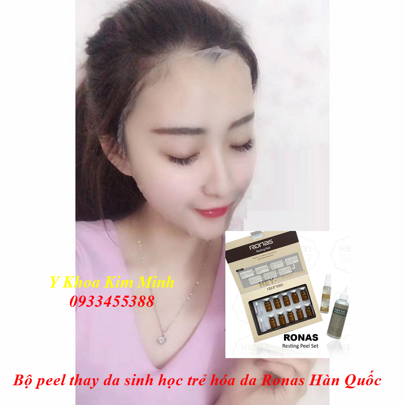 Bộ peel thay da sinh học Hàn Quốc Ronas - Y khoa Kim Minh Bo peel thay da sinh hoc Han Quoc, Ronas vi kim tao silic - Y khoa Kim Minh