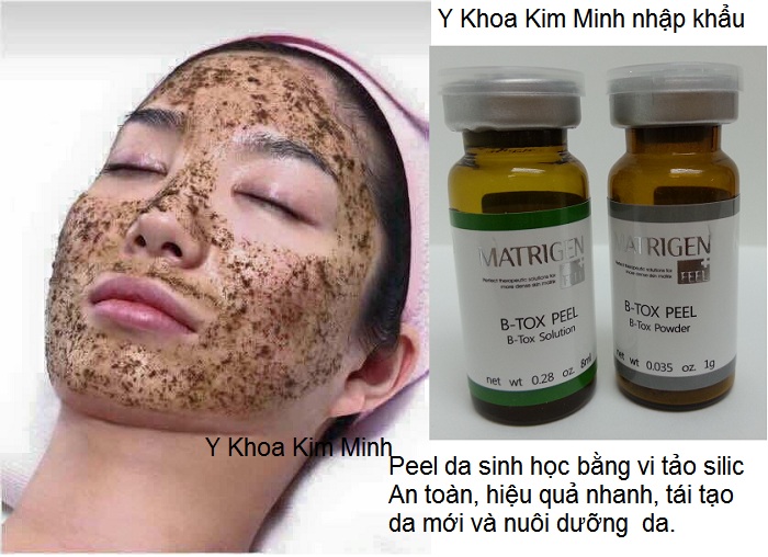 Peel thay da sinh hoc bang vi tao silic B-Top Peel Matrigen han Quoc Y Khoa Kim Minh nhap khau