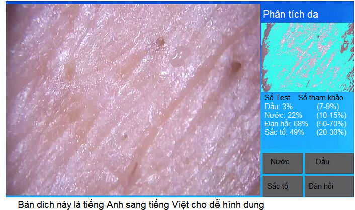 Phân tích da qua wifi nối Ipad - Y khoa Kim Minh Phân tích da qua máy soi da mini ipad nối Wifi - Y Khoa Kim Minh 093455388