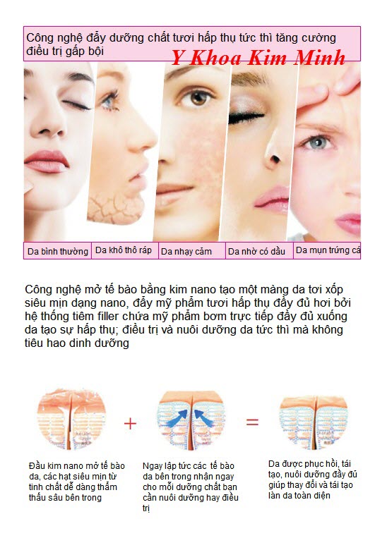 Phuong pháp điều trị nám, trắng sáng trẻ hóa da bằng máy phi kim nano filler PL-218 - Y khoa Kim Minh 0933455388
