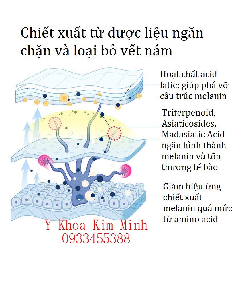 Phương pháp điều trị nám bằng thảo dược viên trắng đông y