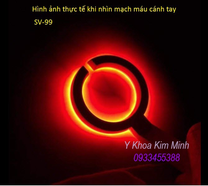 Đèn chiếu ánh sáng cầm tay tìm tĩnh mạch - Y khoa Kim Minh Den chieu canh tay tim vien tinh mach - Y khoa Kim Minh
