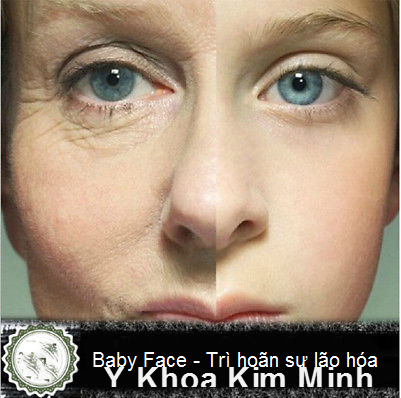 Serum Peptide Matrixyl 3000 Baby Face - trì hoãn sự lão hóa - Y khoa Kim Minh