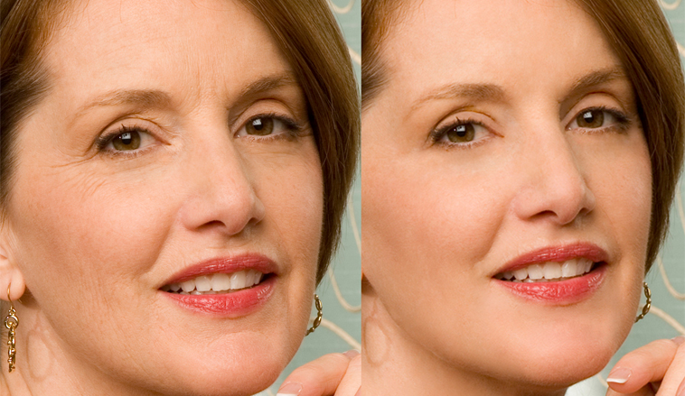 Ban gia si serum Vitamin C H&agrave;n quốc Y Khoa Kim Minh