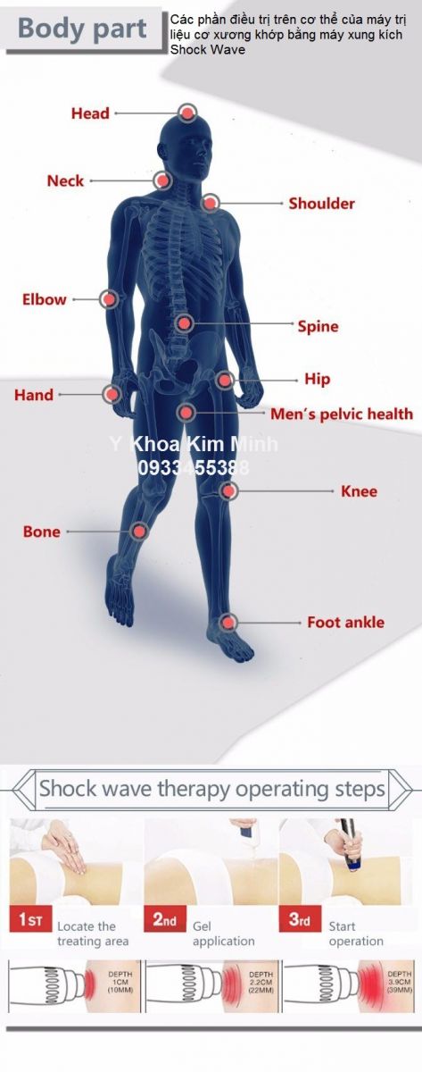 Các phần điều trị cơ xương khớp trên cơ thể bằng sóng xung kích Shock Wave - Y khoa Kim Minh Cac phan tri lieu dau co xuong khop dung voi may tri lieu bang song xung kich Shock Wave - Y khoa Kim Minh 0933455388