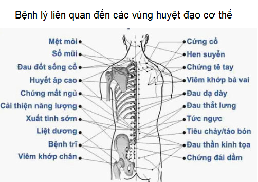 Bệnh lý thần kinh tọa có chữa được không, máy chữa bệnh thần kinh tọa Shockwave-2019 - Y khoa Kim Minh 0933455388