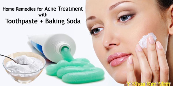 Chua da viem mun va mun trung ca bang soda paking Y Khoa Kim Minh