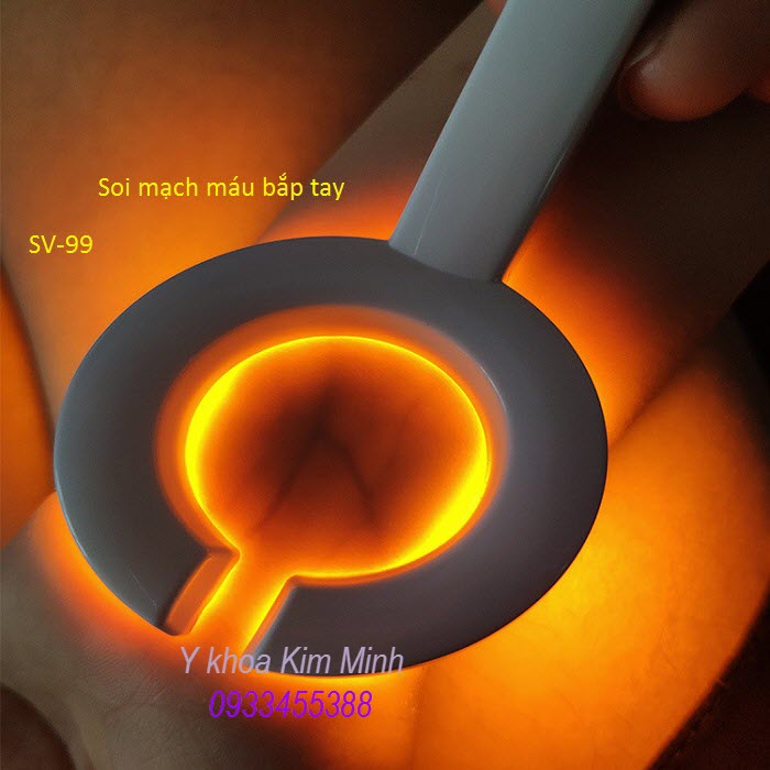 Dùng soi mạch máu cánh tay - Y khoa Kim Minh Soi mạch máu cánh tay tìm vein và tĩnh mạch với đèn SV-99 - Y Khoa Kim Minh