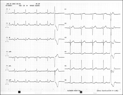 Suzuken Cardio 601 Made in Japan