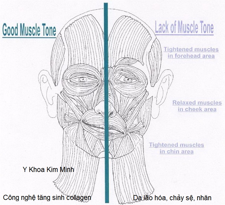 Cong nghe thay da sinh hoc tang sinh collagen-elastin chong lao hoa chay se bio electricity Y Khoa Kim Minh