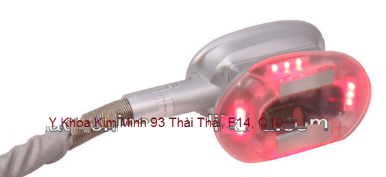 m&aacute;y giảm mỡ c&ocirc;ng nghệ quang đ&ocirc;ng cryolipolysis