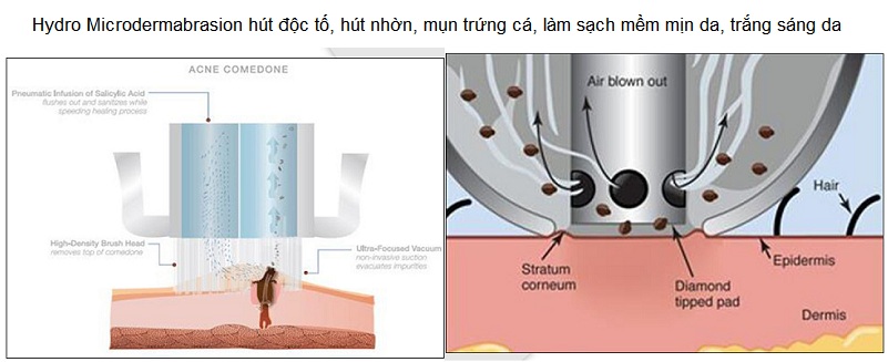 Tay cam hut doc to lam sach da, tre ho da KW - Y Khoa Kim Minh