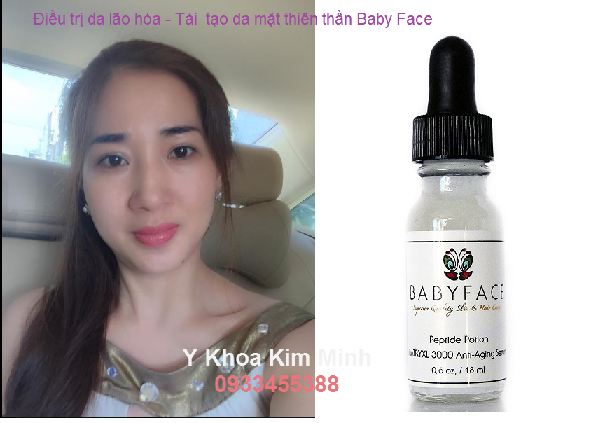 Serum te bao goc Baby Face, tái tạo da mặt thiên thần, trì hoãn lão hóa toàn diện - Y Khoa Kim Minh