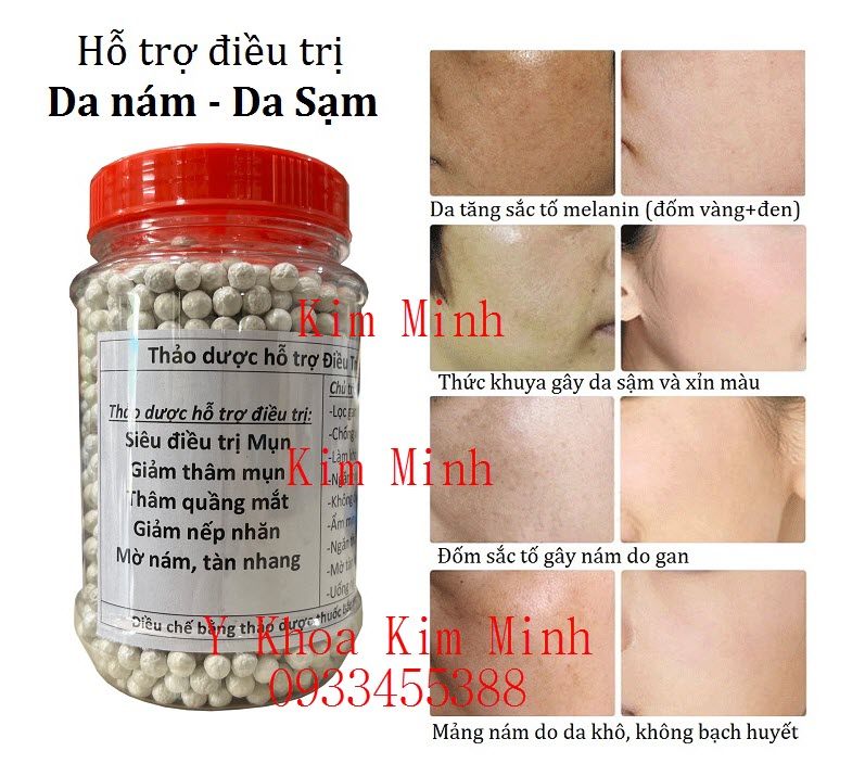 Viên thảo dược trắng giúp điều tri da nám hiệu quả như mong đợi