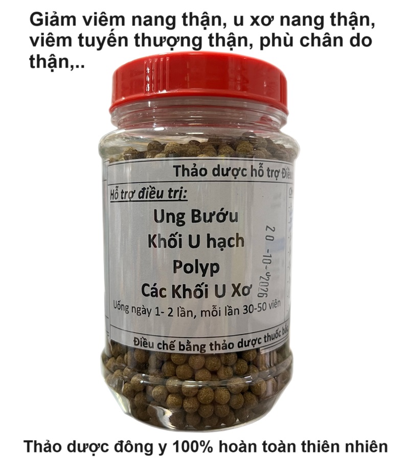 Thảo dược đông y hỗ trợ chữa bệnh phù chân do thận, phù chân do tiểu đường