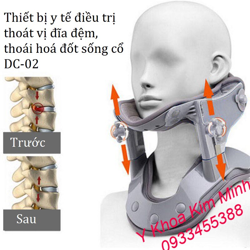 Hỗ trợ điều trị và phục hồi thoái hoá đốt sống cổ Thiết bị điều trị thoái hoá cột sống cổ và xẹp đĩa đệm DC-02