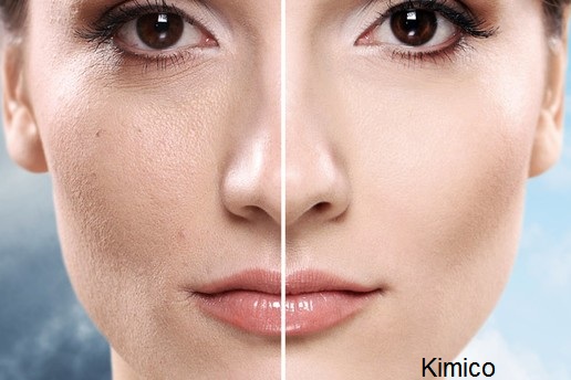 May thiet bi bio electricity thay da sinh hoc tang sinh collagen chong lao hoa Y Khoa Kim Minh