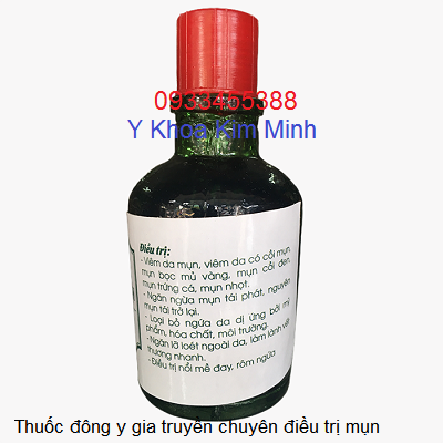 Thuốc điều trị mụn gia truyền - Y Khoa Kim Minh Thuoc dong y chuyen dieu tri mun gia truyen - Y khoa Kim Minh 0933455388