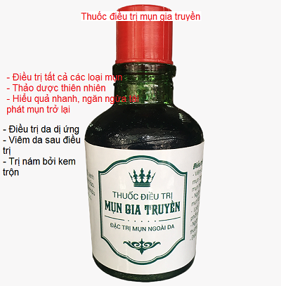 Thuốc chuyên điều trị mụn mủ, mụn viêm, dị ứng gây mụn nhanh nhất - Y khoa Kim Minh Thuốc điều trị mụn, se cồi mụn, giảm viêm mụn nhanh và hiệu quả sau 2 ngày - Y khoa Kim Minh