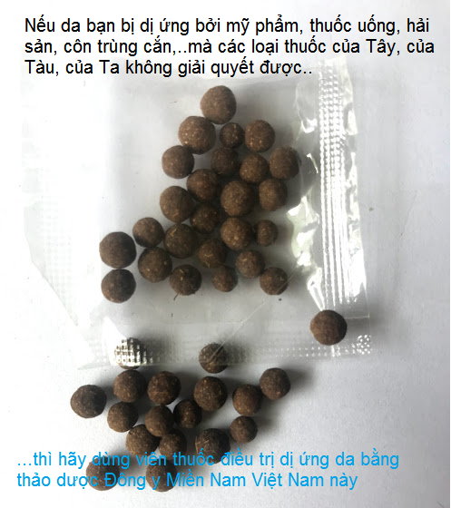 Viên uống điều trị da dị ứng ngứa, phong, phát ban đỏ bằng thảo dược Đông y Miền Nam Việt Nam - Y khoa Kim Minh Viên thuốc thảo dược Đông y Miền Nam Việt Nam chữa da dị ứng, phong ngứa, phát ban, nổi mề đây nổi khắp người - Y Khoa Kim Minh