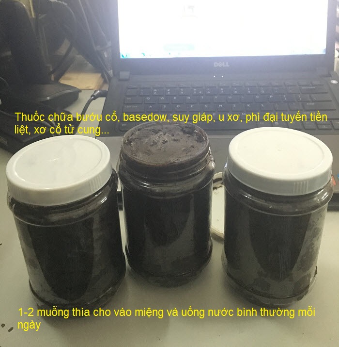 Thuoc chua benh buou co basedow, suy giap, cuong giap, u xo tu cung, tuyen tien liet Y Khoa Kim Minh